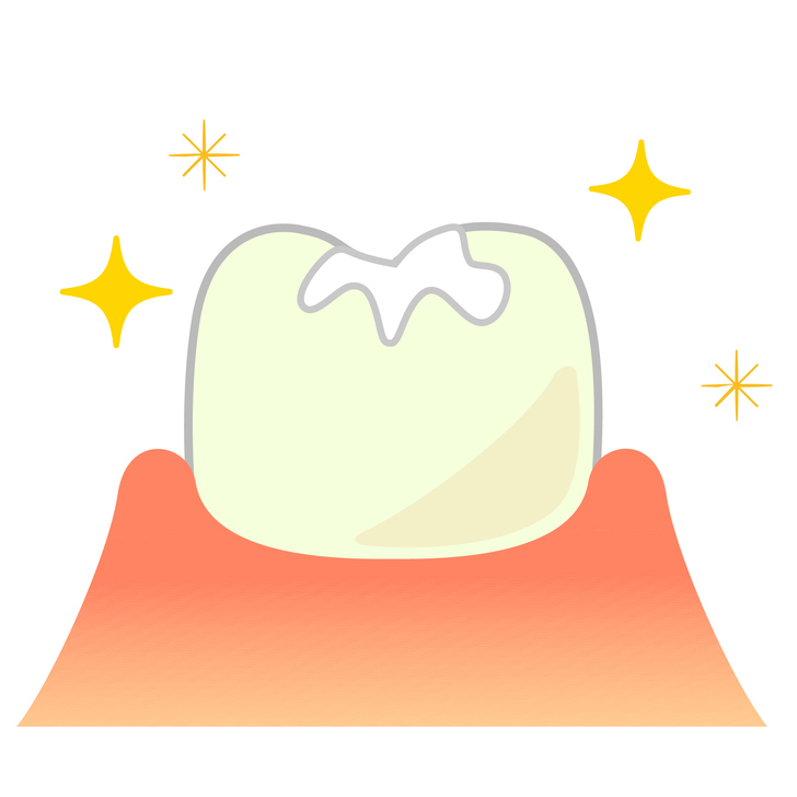 布施の虫歯の治療