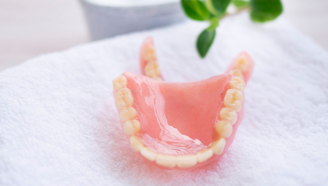 布施のノンクラスプデンチャー