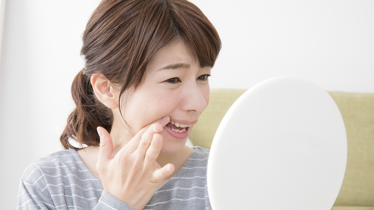 布施の歯ぎしりの治療（ナイトガード）