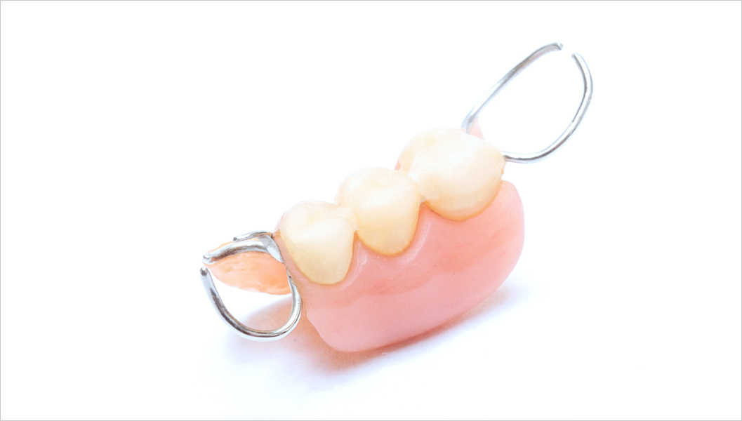 布施のノンクラスプデンチャー