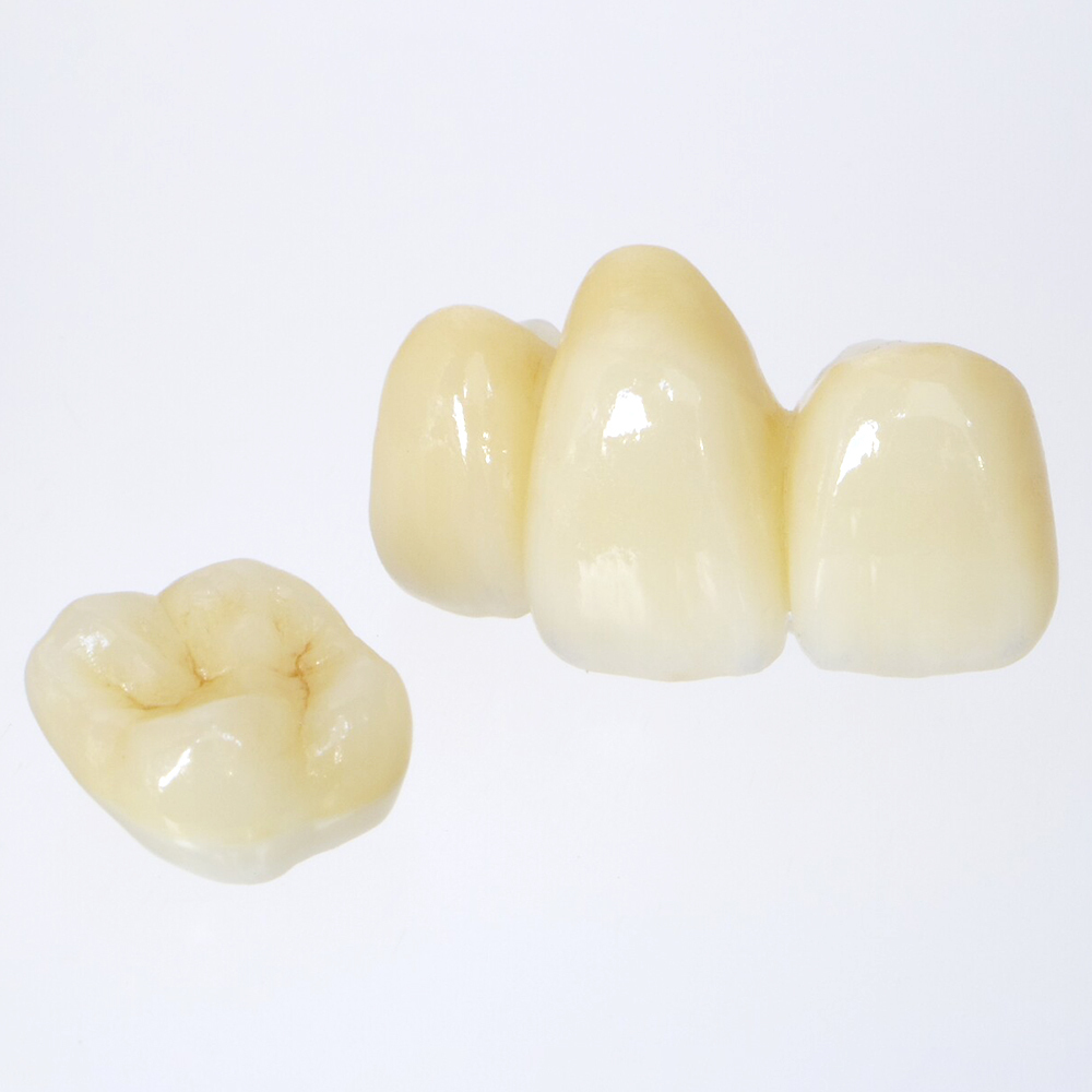 布施のメタルフリー