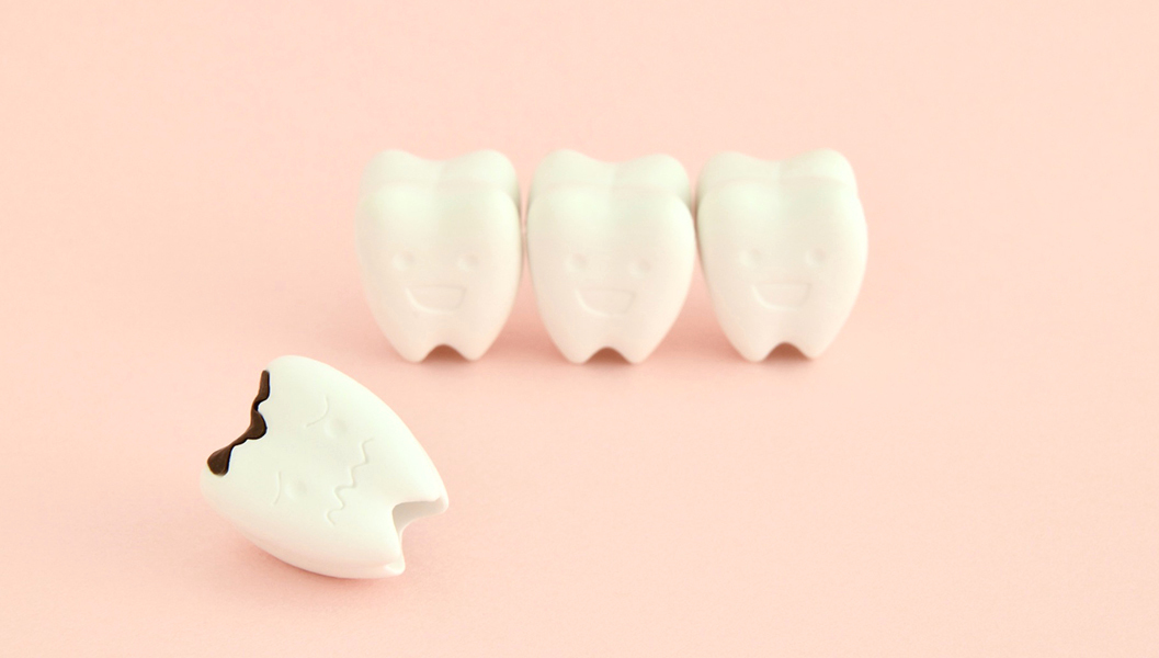 布施のなるべく歯を削らない治療