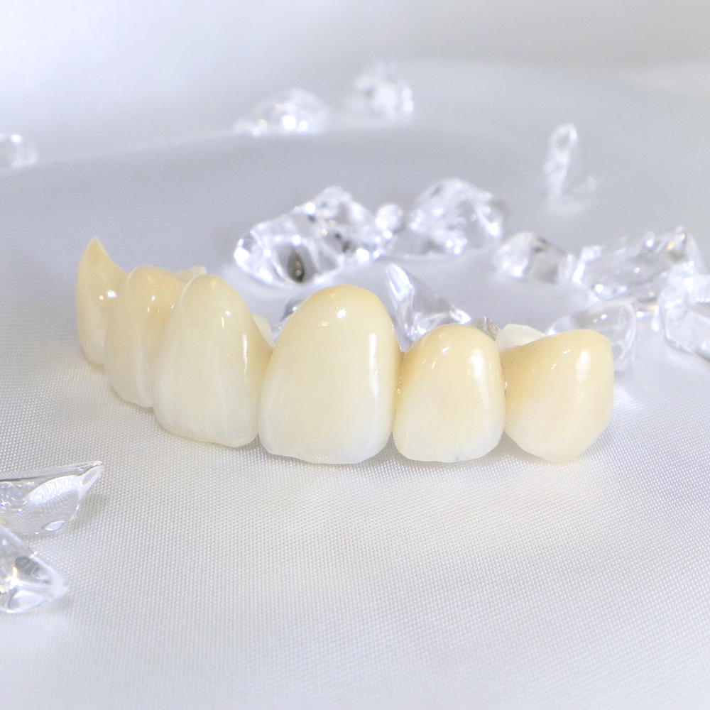 布施のメタルフリー