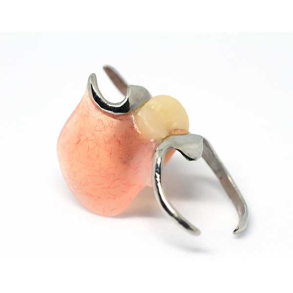 布施のノンクラスプデンチャー