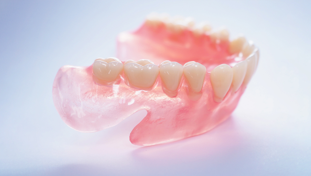 布施のノンクラスプデンチャー