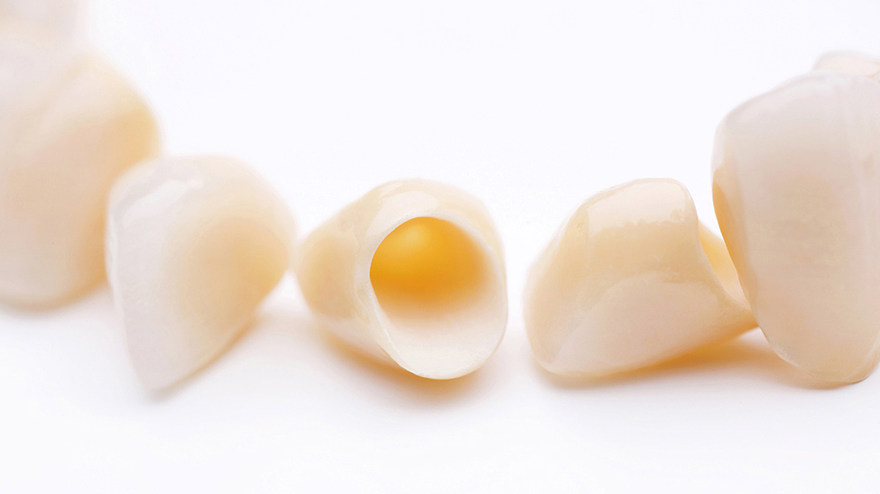 布施のメタルフリー