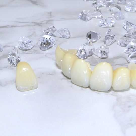 布施のセラミック治療