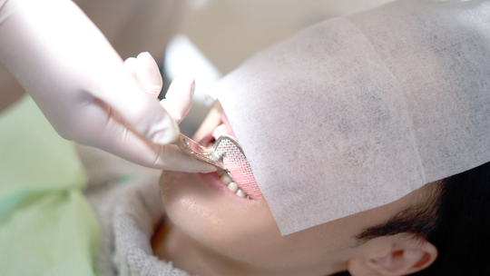 布施の入れ歯の治療