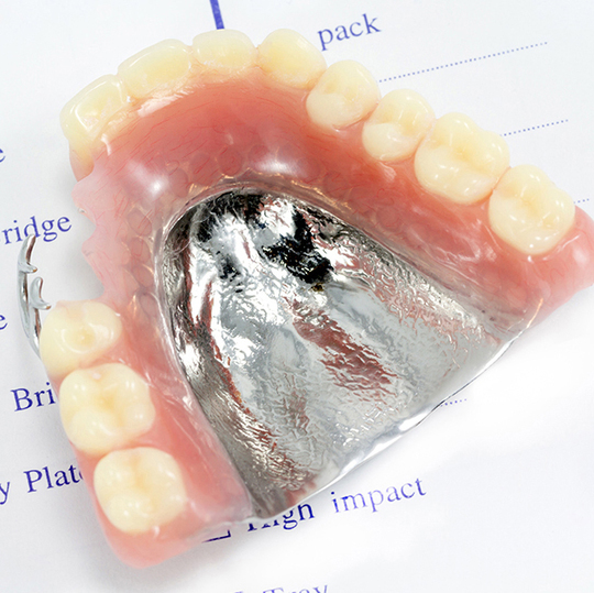 布施の入れ歯の治療