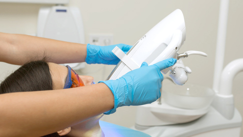 布施のホワイトニング