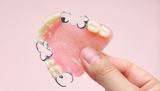 布施のノンクラスプデンチャー