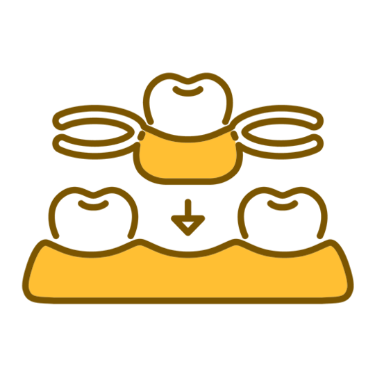 布施の入れ歯の治療