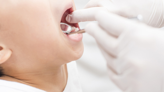 布施の小児歯科