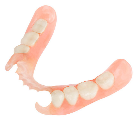 布施のノンクラスプデンチャー