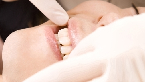 布施のホワイトニング