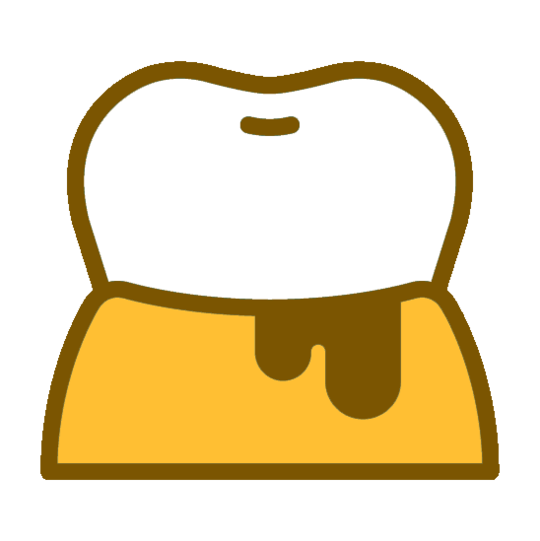 布施の歯周病の治療