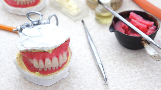 布施の入れ歯の治療