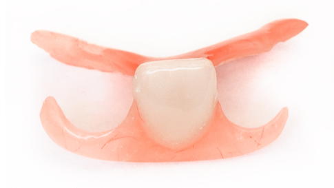 布施の入れ歯の治療