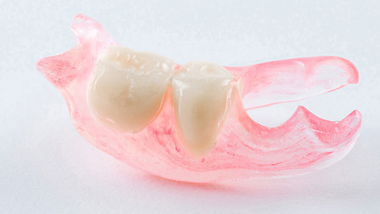 布施の入れ歯の治療