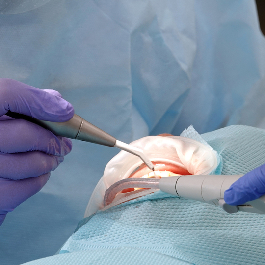 布施の歯周病の治療