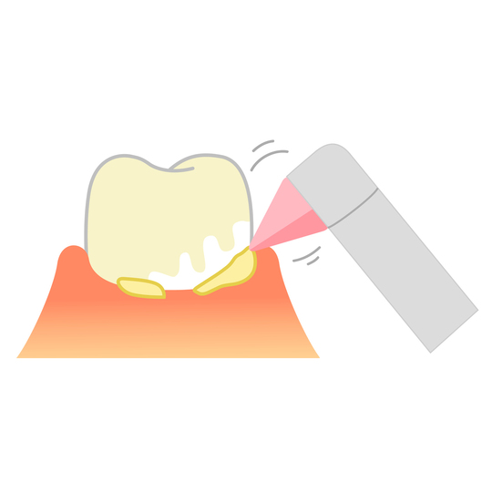 布施の小児歯科