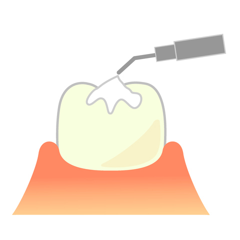 布施の小児歯科