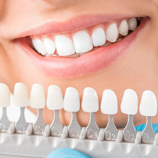 布施のオフィスホワイトニング