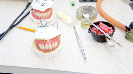 布施の入れ歯の治療